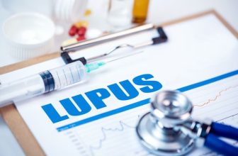 Alimentos Que Pueden Aumentar El Riesgo De Lupus